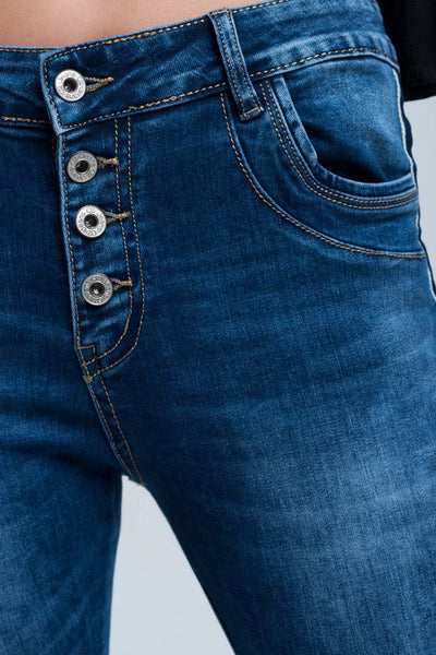 Striped Skinny Jeans